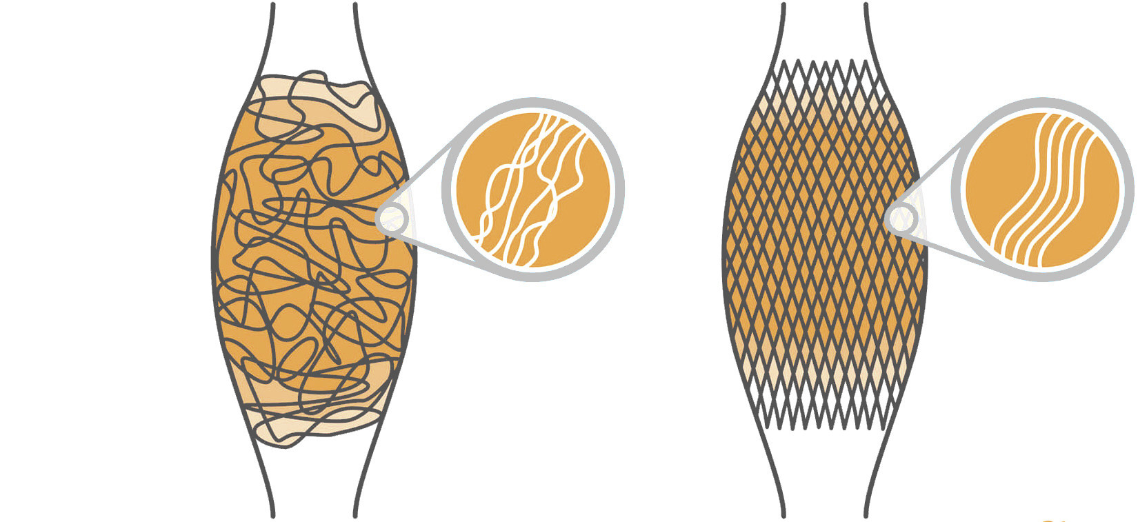 Faszien – verfilzt und gesund