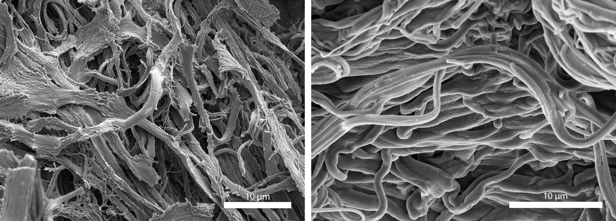 Faszien – verfilzt und gesund
